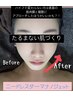 エステ版！ダウンタイム無しの最新水光微細針！【ニードレスナノジェット】