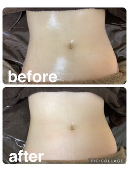 ギンザアール(GINZA R.)/美くびれボディに！