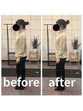 熊本カワル整体 JR上熊本駅院/姿勢改善