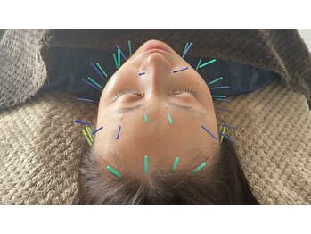 東京鍼灸整骨院/美容鍼に自信あり!