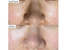 ユイット ルッカ(Huit Lucca)の雰囲気(ハイドロフェイシャルでしつこい毛穴汚れを改善☆)