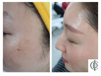 ベラ 東京院(Bella)/インセルダム-ICD-韓国最新美容