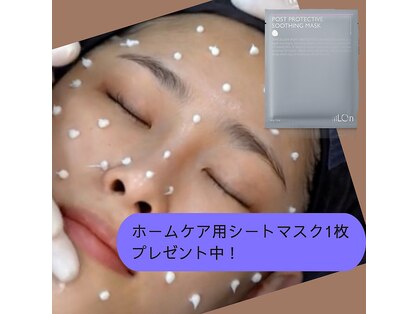 アンリュサックルの写真