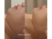 ビメガミ(美 MEGAMI)