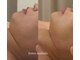 ビメガミ(美 MEGAMI)の写真/フェイスラインもボディも思い通りのラインへ。もうわがままボディには戻らない。半永久的に脂肪とさよなら