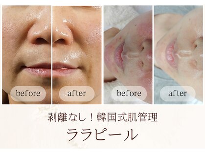 アルセ(arce)の写真