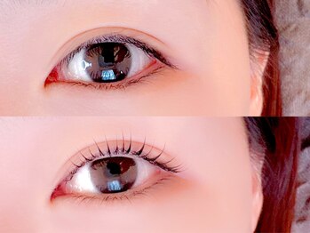 エミフィ(Emiphi)/