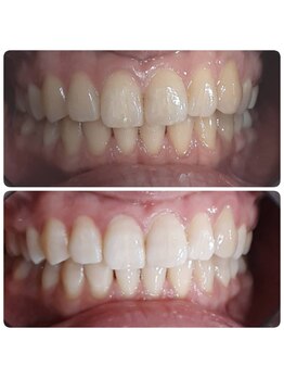 ライトビューティー 本八幡店(LIGHT BEAUTY)/初回30分のお客様