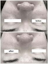 ヒルナム(Heal Nam)/プロセルセラピーズ~フェイス~