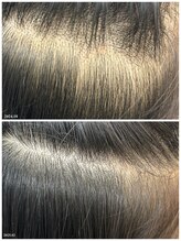 ヒルナム(Heal Nam)/プロセルセラピーズ~頭皮~