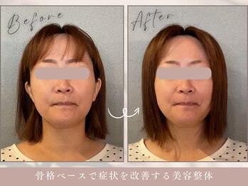 ほぐし屋 かすがい/小顔リフト矯正+美姿勢整体