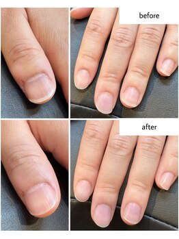 ケアプラス(care plus)/ハンドネイルケア