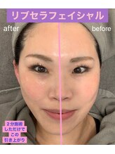 プリュネル(Prunelle)/プラズマシャワー