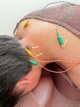 アプレシエ(Apprecier)/肩こり腰痛に聞く！電気鍼×整体