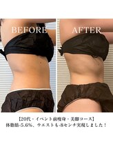 ヨサパーク サンテ 祐天寺(YOSA PARK sante)/痩身/ダイエット/よもぎ蒸し痩身