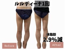 ヨサパーク ポノン(YOSA PARK ponon)/【Before→After】