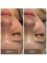 エヌア(nA)/ビフォーアフタービオフィート♪