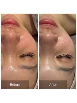 エヌア(nA)/ビフォーアフタービオフィート♪