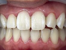 ホワイトニングバー 大宮店