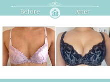 美人バスト 浜松店の雰囲気（理論に基づくバストアップだからこそ最短でバストアップが叶う☆）