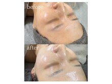 サロンナナジュウニ(Salon72)/雪肌美白/くすみ