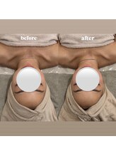 &still【アンドスティル】【4/1 NEW OPEN（予定）】 /【小顔コルギ】