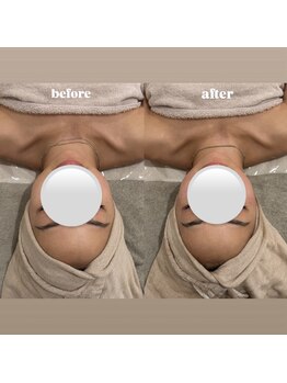 &still【アンドスティル】【4/1 NEW OPEN(予定)】 /【小顔コルギ】