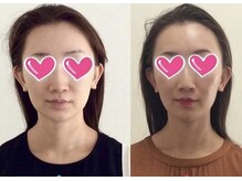 mano【小顔矯正/リンパマッサージ/筋膜リリース】/小顔矯正