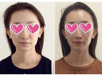 mano【小顔矯正/リンパマッサージ/筋膜リリース】/小顔矯正