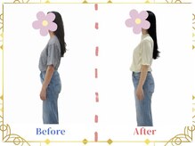 ルーチェ ルシーナ(Luce Lucina)/反り腰改善