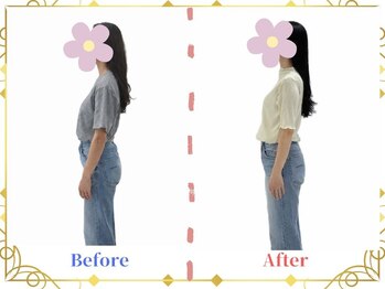 ルーチェ ルシーナ(Luce Lucina)/反り腰改善