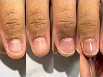 受験中は必ずむしっていたんです