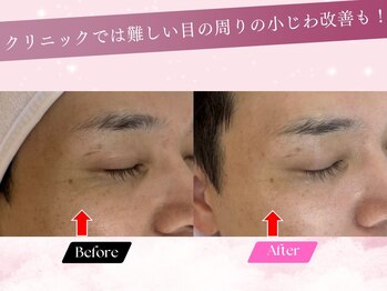 ルーム701(room701)/シミ シワ 高級フェイシャル