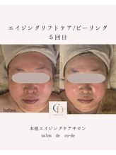 サロンドコーデ(salon de co-de)/エイジングリフトケア