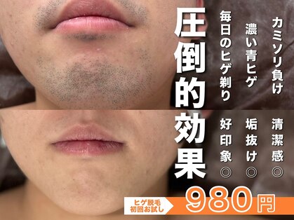 メンズ脱毛サロン ボス(BOSS)の写真