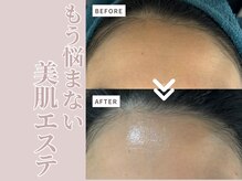 年を追うごとに気になるシワ・たるみ・毛穴などお任せください！