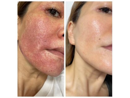 パリライム(parislime)の写真