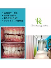 ライズビューティーサロン(Rise Beauty Salon)/☆ビフォーアフター☆