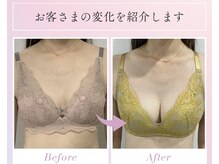 リターズ鍼灸治療所 天王寺院の雰囲気（育乳鍼の効果をぜひ体験ください）
