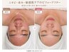 【肌質改善】毛穴・くすみ・乾燥を整える美肌フェイシャル80分¥12000
