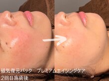 ルーナジェーナ(Luna llena)/