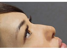 マツエクサロン ミック 下通り店(Mic)/横から見られる事を意識♪