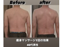 リアン(Lien)/Before/after