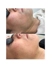 エリクサー 太田店(Elixir)/before after