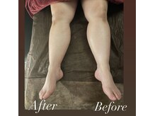 禅(ZEN)/マタニティ整体