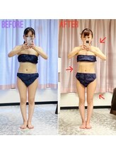 エステティックサロン アール 大阪梅田(esthetic salon R)/30代女性　before→after♪