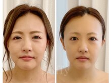 フラフィ 宇都宮本店(fluffy)/見た目年齢-5歳！！