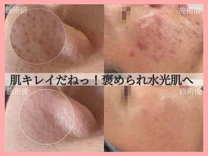 ハイフン(HIFUN)の写真