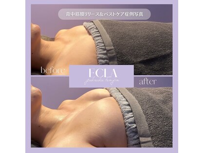 エクラ 天神店(ecla)の写真