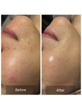 エヌア(nA)/ビフォーアフタービオフィート♪